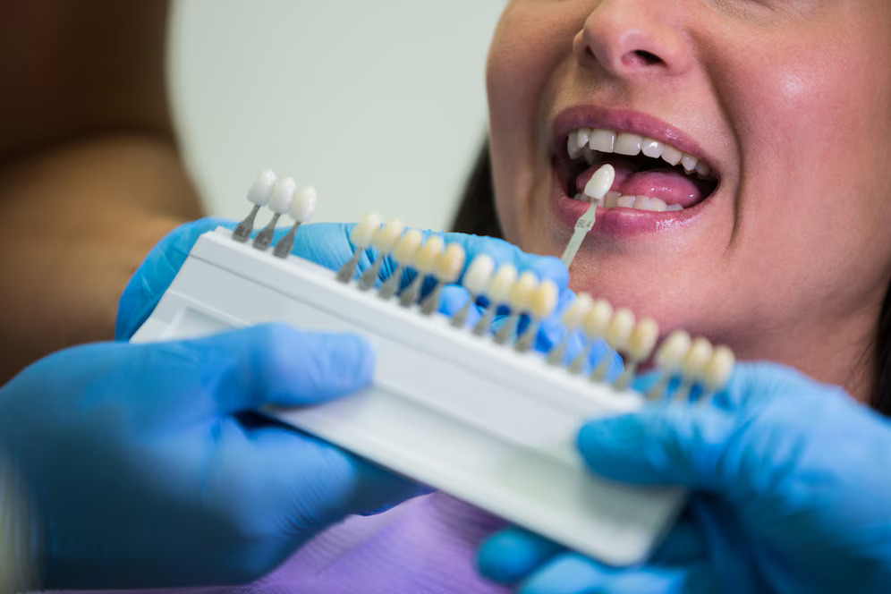 Cosmetic Dentistry
